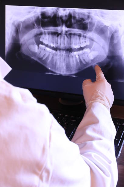 Best Broken or Chipped Tooth Repair in Woodmore, MD